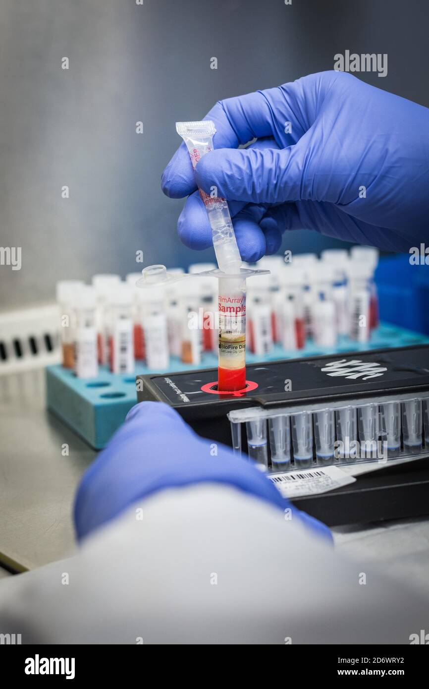 Processing of BioFire ® FilmArray tests. This test provides reliable results for the identification of 23 targets (viruses and bacteria) responsible f Stock Photo