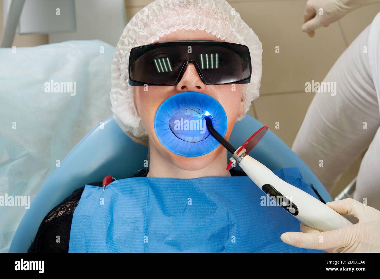 Dental dam hires stock photography and images Alamy