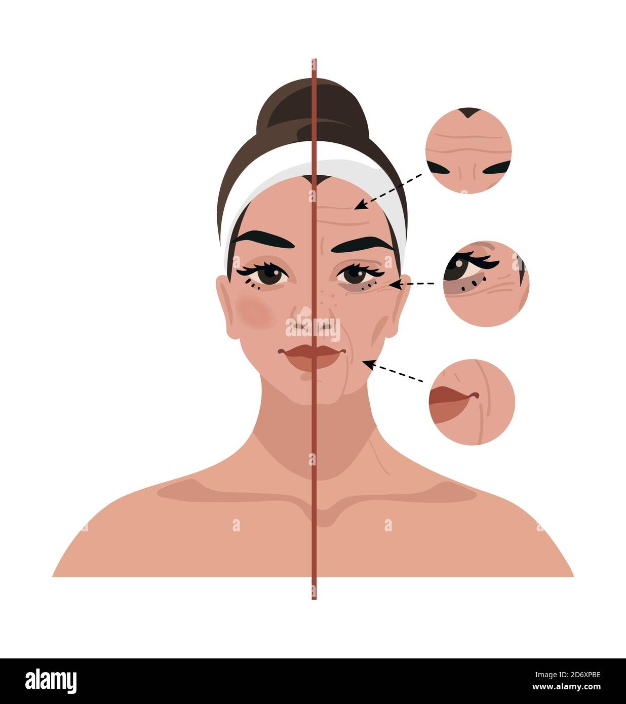Portrait of a young woman and age-related changes on her face. Before and after cosmetic procedures, injections, plastic surgery. Flat vector illustration Stock Vector