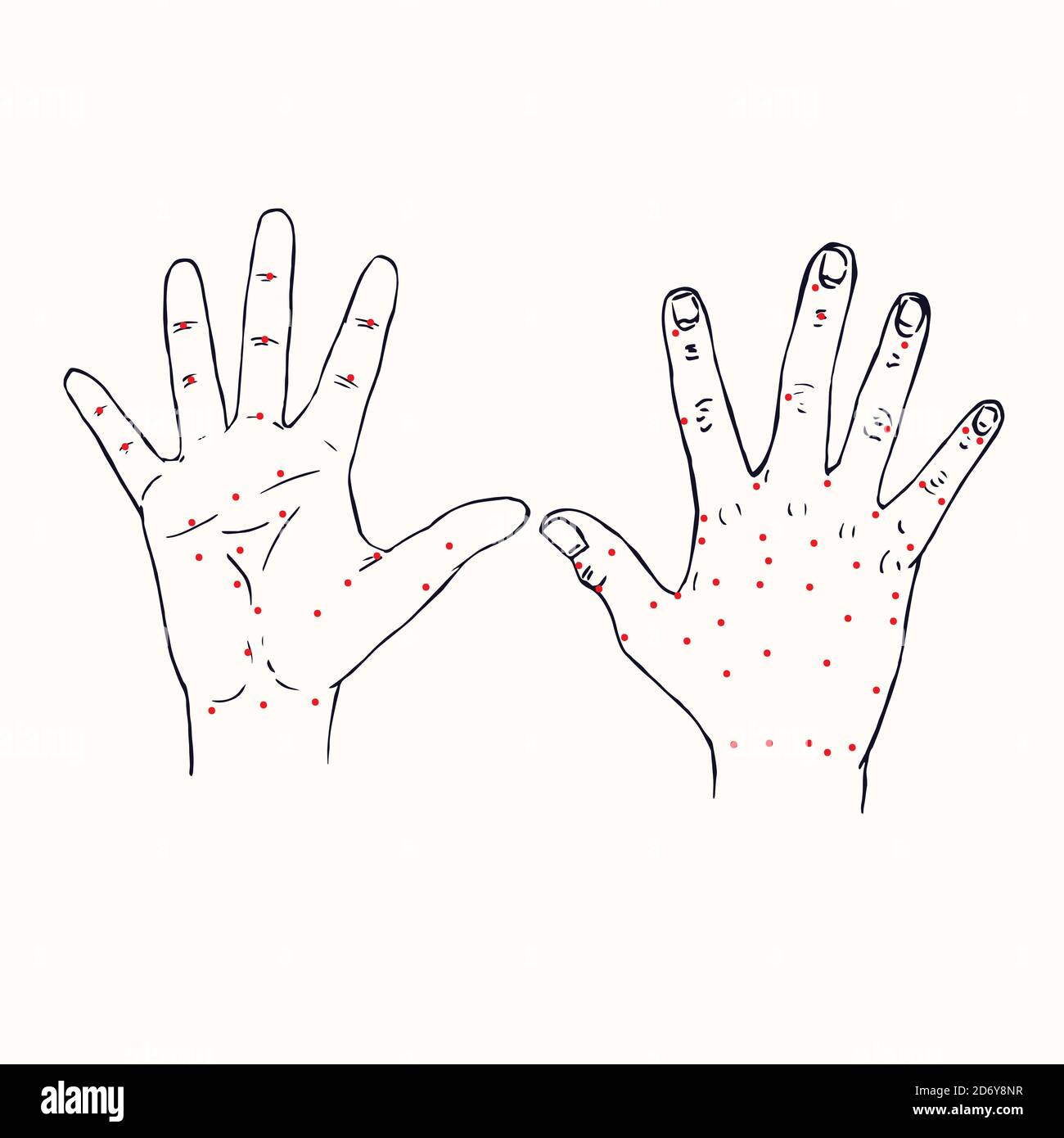 Hands (palm and dorsum of right hand) Chinese acupuncture scheme with