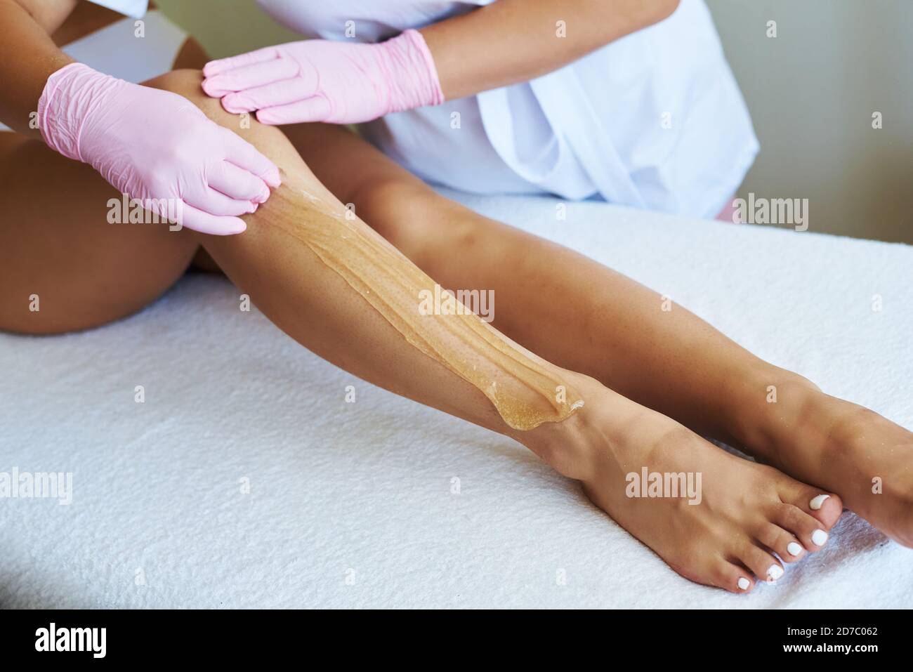 Cosmetologist is applying epilation paste. The hair removal procedure. Stock Photo