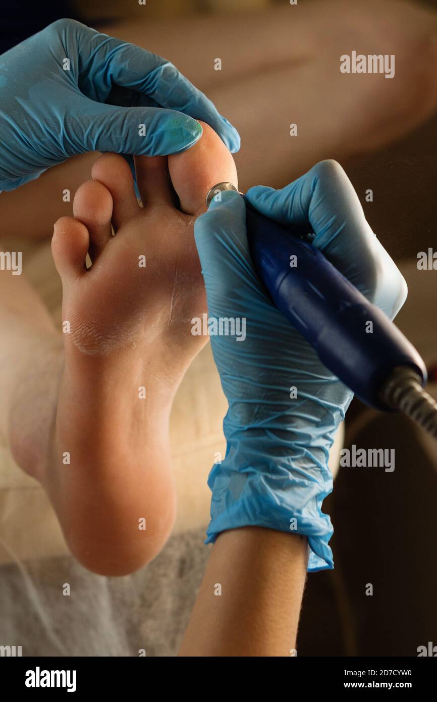 Podiatrist using grinding equipment and making procedure polish for feet hardware pedicure