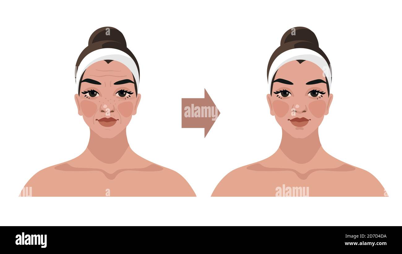 Before and after, illustrations for a beauty salon, cosmetic procedures, plastic surgery, facial massage, lymphatic drainage techniques. Female portrait with age-related changes. Vector isolated on white background Stock Vector