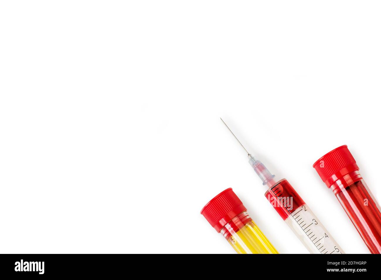 Test tubes and a syringe with urine and blood on a white background ...
