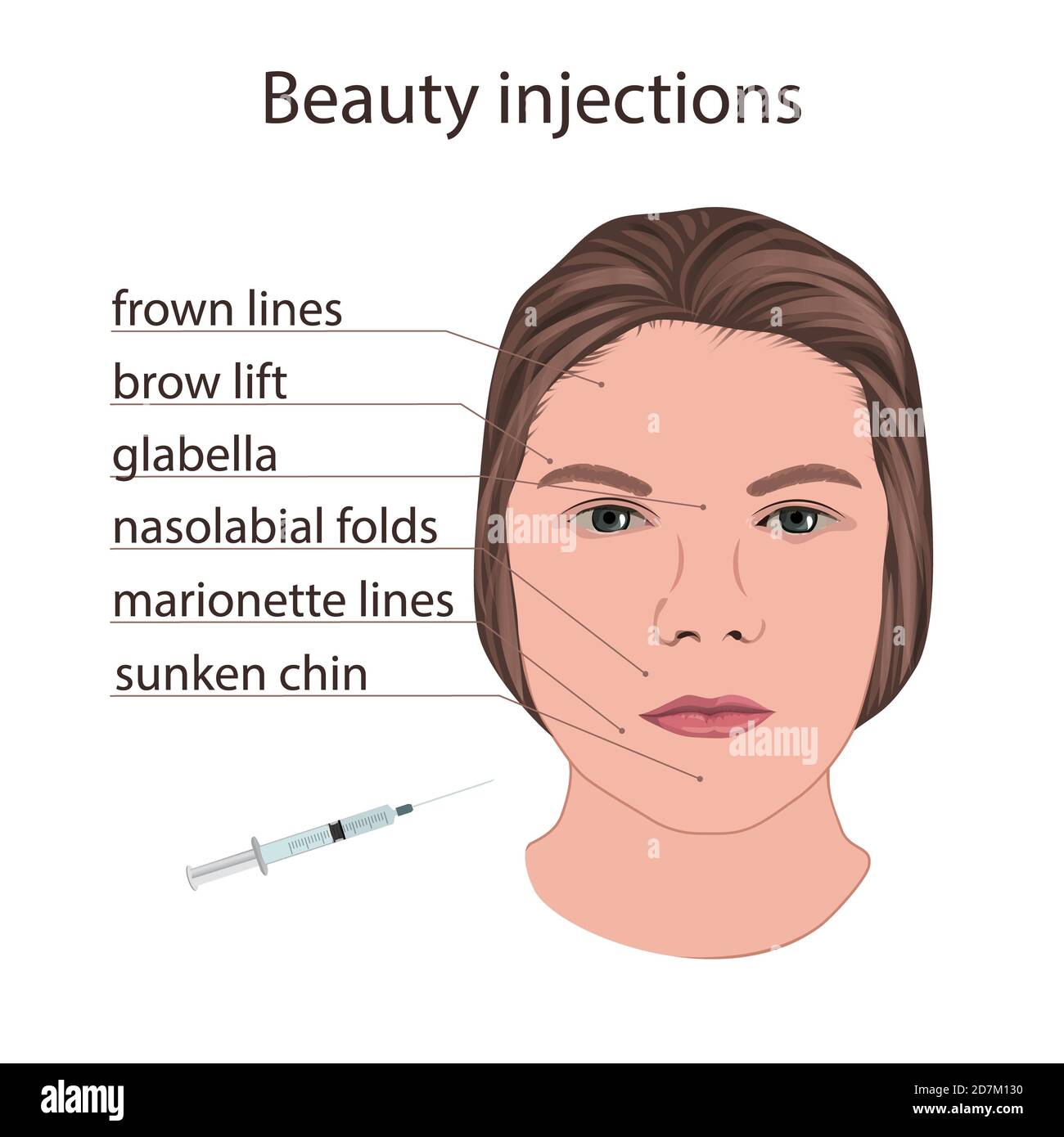 Scheme for beauty injections, illustration. Stock Photo