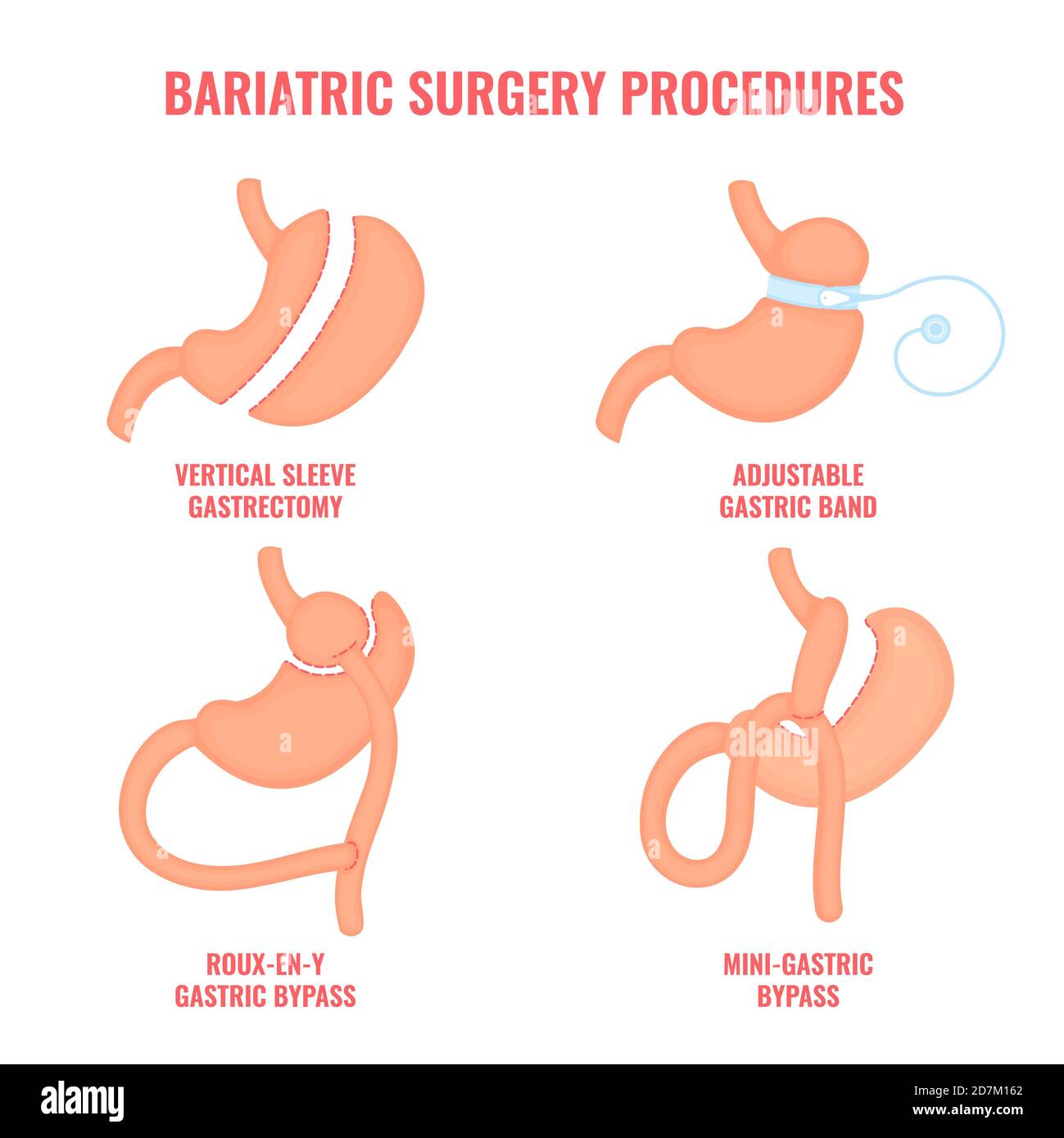 Bariatric Must Haves