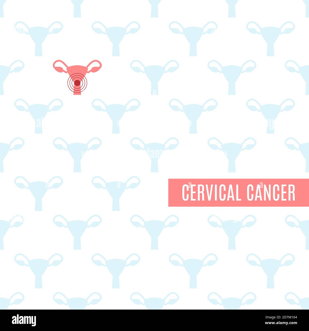 Cervical cancer poster, conceptual illustration Stock Photo - Alamy