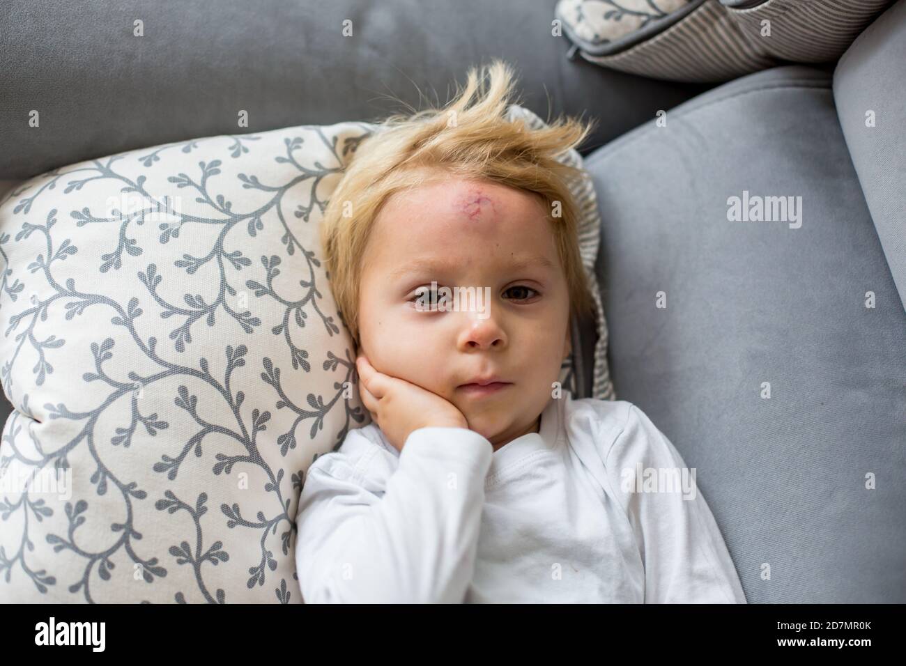Toddler boy, lying on the couch at home with big bump on the forehead
