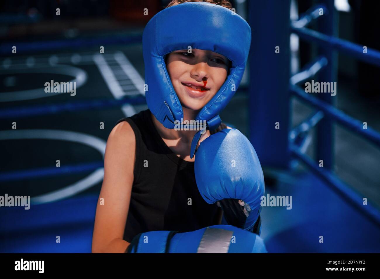 Nose Bleed High Resolution Stock Photography and Images Alamy