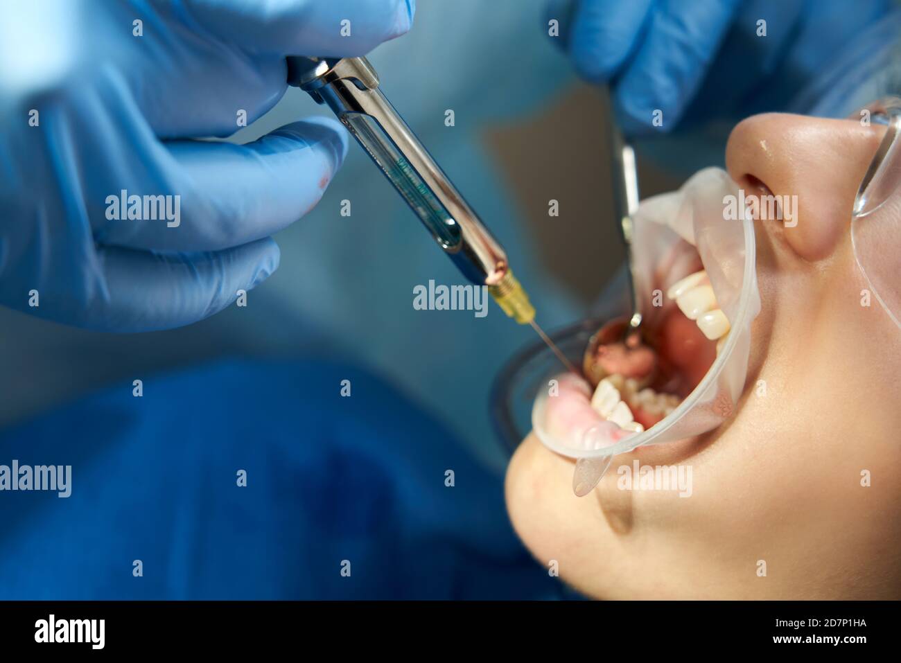 Dentist making local anesthesia shot before surgery. Patient visiting a