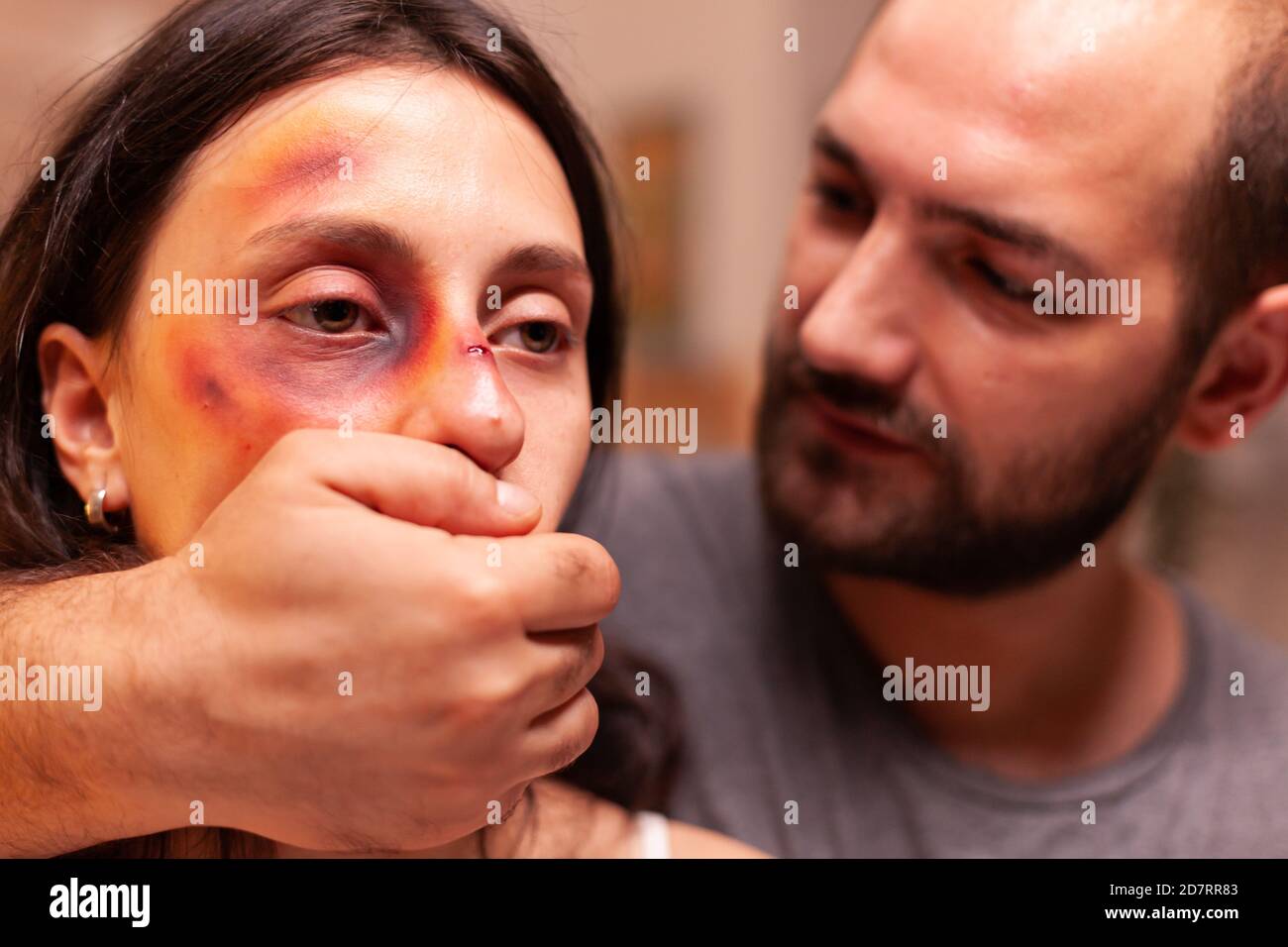 Husband traumatising wife after beating and making her face full of bruises. Violent aggressive husband abusing injuring terrified helpless, vulnerable, afraid, beaten and panicked wife. Stock Photo