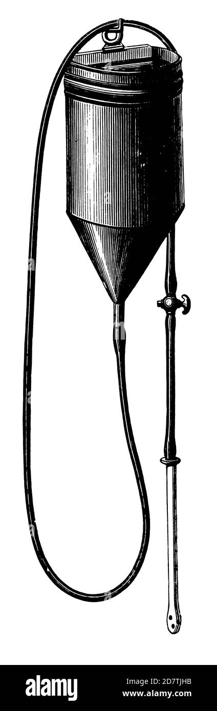 Antique illustration of an enema equipment (isolated on white). Published in Specimens des divers caracteres et vignettes typographiques de la fonderi Stock Photo