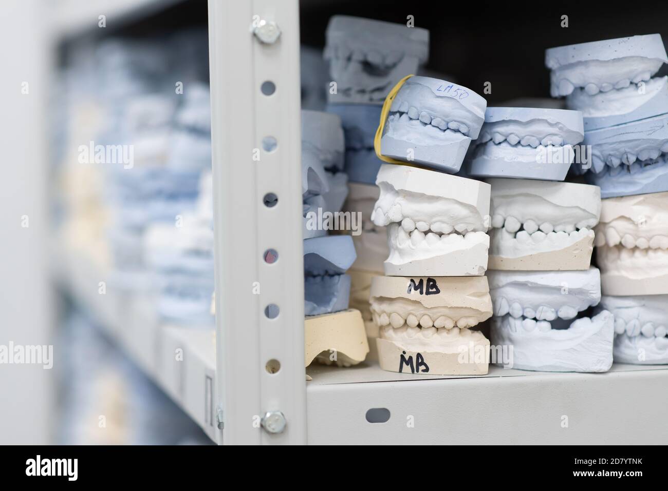 Place of storage of plaster models of human jaws in an orthodontic