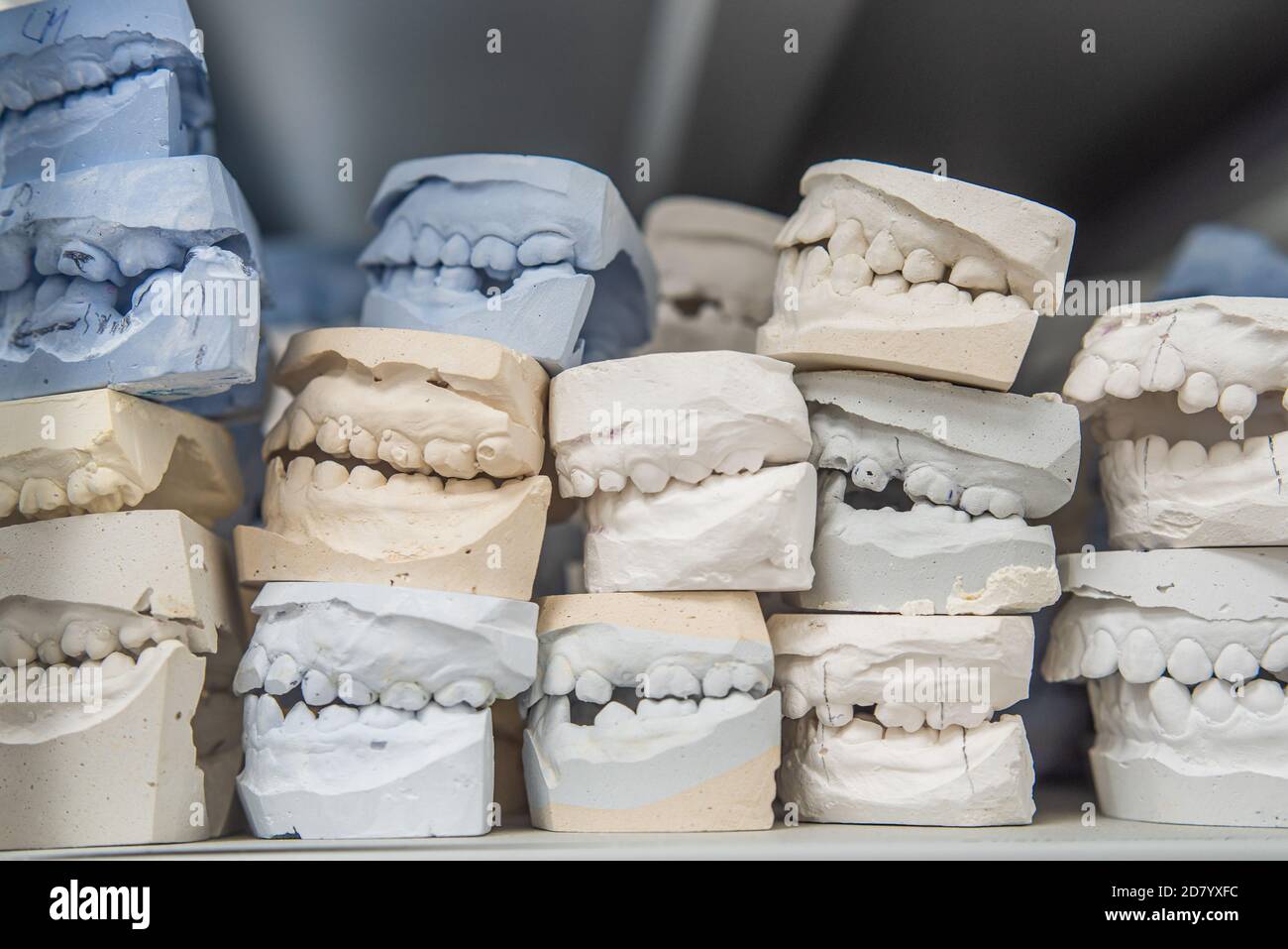 Place of storage of plaster models of human jaws in an orthodontic