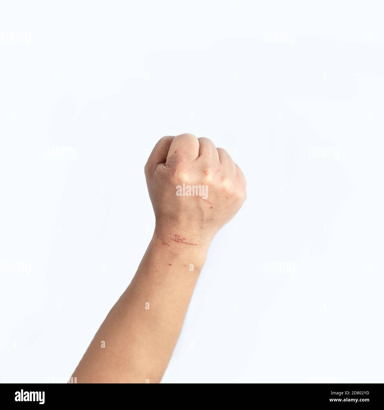 The close-up fist is full of scars Stock Photo