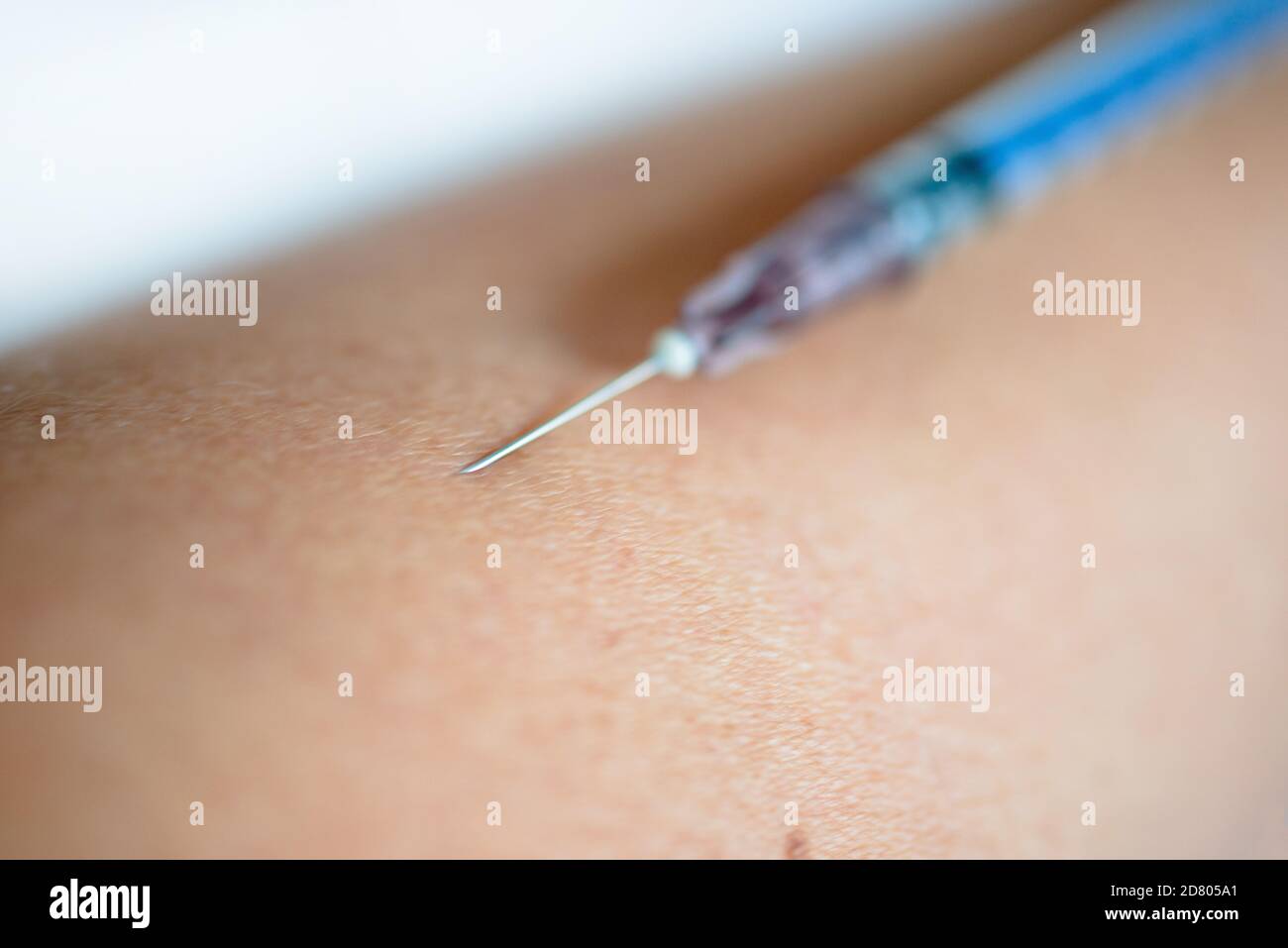 The syringe needle sticks into the skin.Getting vaccinated. Stock Photo