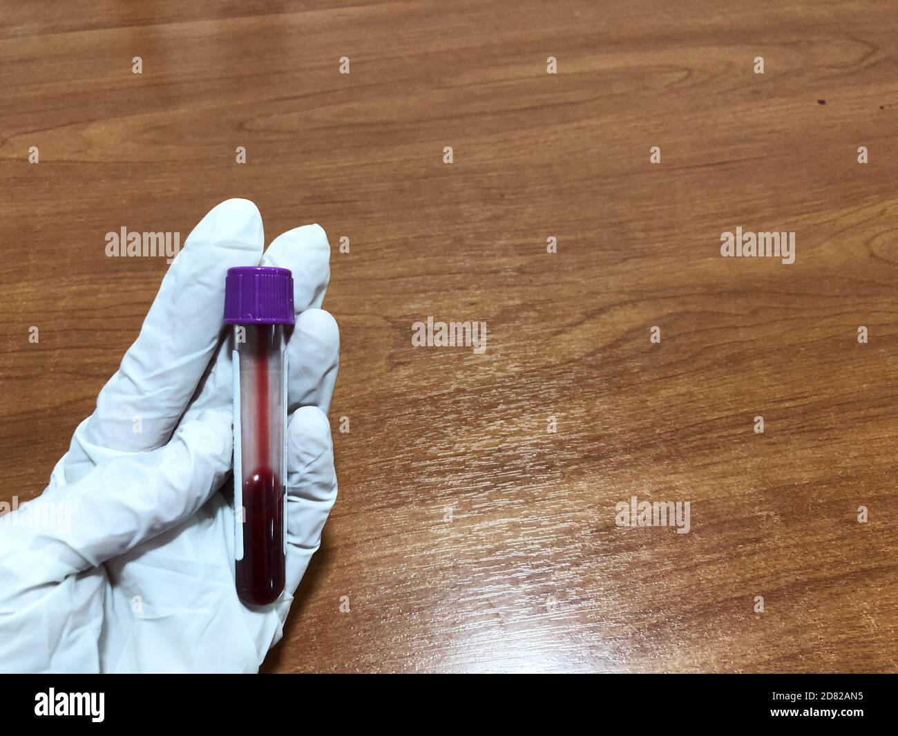 Test tube plasma in hands hi-res stock photography and images - Alamy