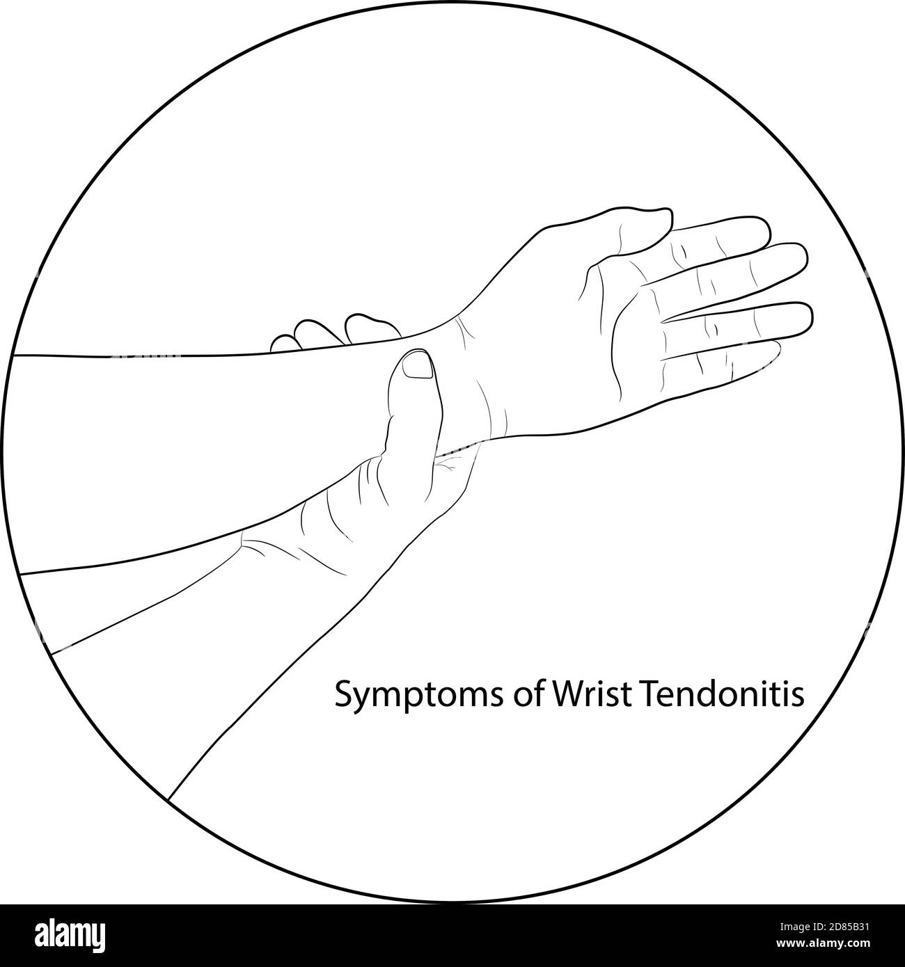 image graphics vector outline Wrist pain is often caused by sprains or fractures from sudden injuries concept health care Stock Vector