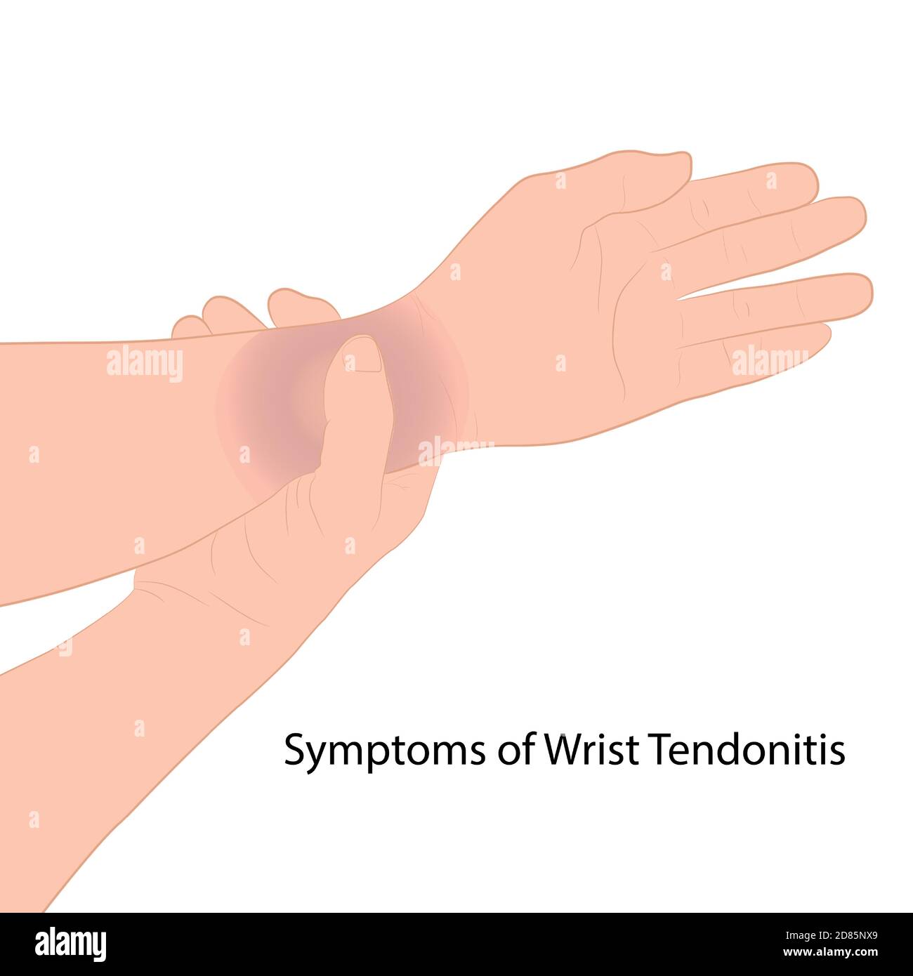 image graphics vector outline Wrist pain is often caused by