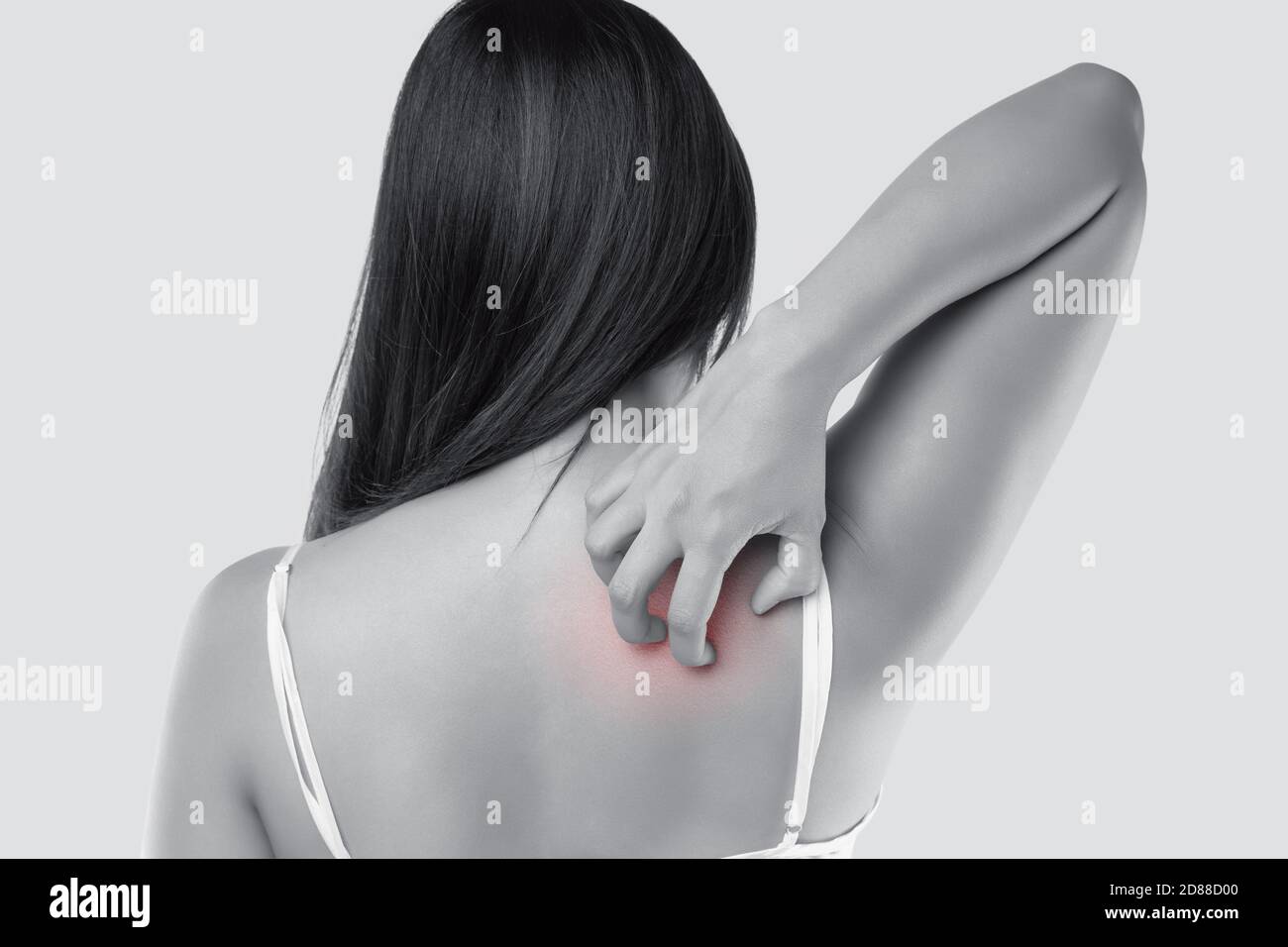 A woman scratching their back due to itching. Female with sensitive skin on a gray background. The concept of allergy symptoms and healthcare. Stock Photo