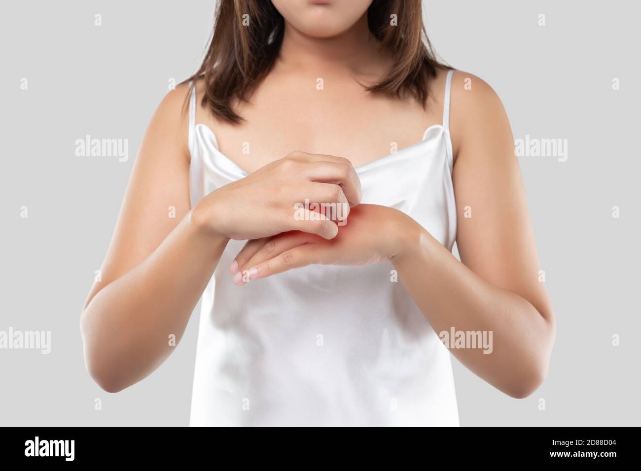 A woman in the white satin dress is scratching their arms due to itching on a gray background. Female with dry skin. The concept of allergy symptoms a Stock Photo