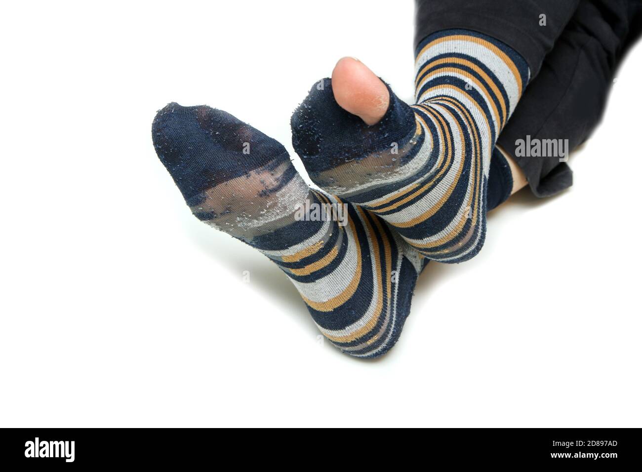 The feet with well worn striped socks isolated on a white background. One has a hole and a toe through it. Stock Photo