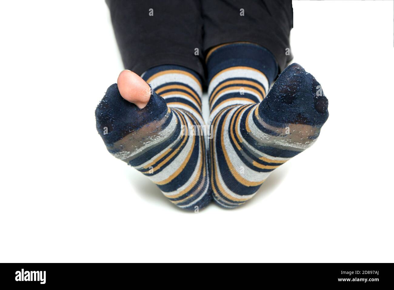 The feet with well worn striped socks isolated on a white background. One has a hole and a toe through it. Stock Photo