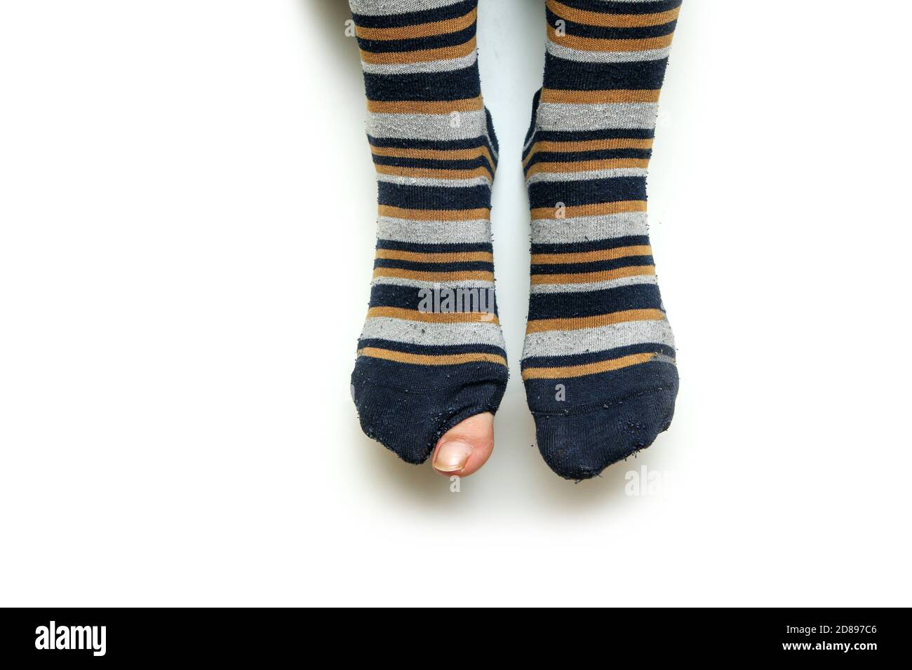 The feet with well worn striped socks isolated on a white background. One has a hole and a toe through it. Stock Photo