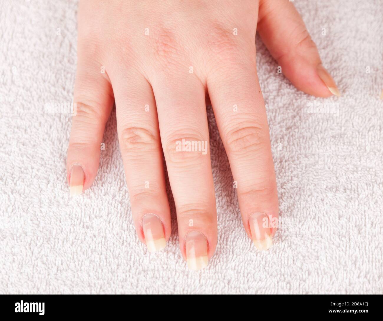 The concept of hand care. Closeup hand before applies nail polish Stock Photo