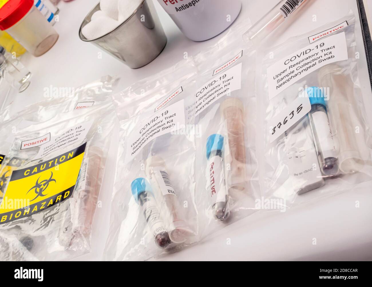 Blood samples from sars-cov2 infected people, preaparatives for Rt-PCR, conceptual image Stock Photo