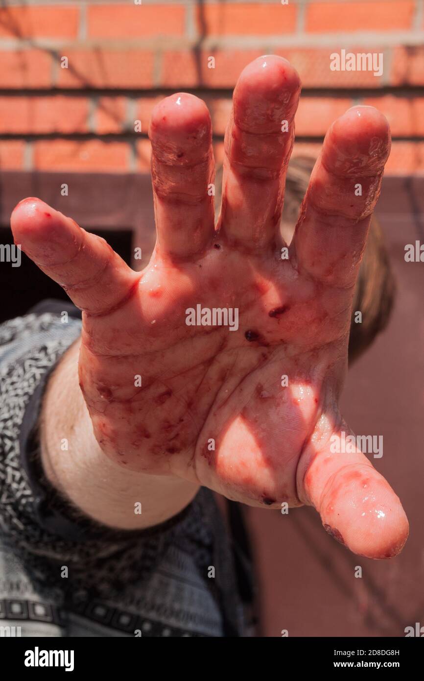 the man closes himself from the photographer with a bloody hand. A hand stained with blood, close-up. Stop the violence. Hands in blood. The fight against cruelty. Social problems of abuse, violence, cruelty. Stock Photo