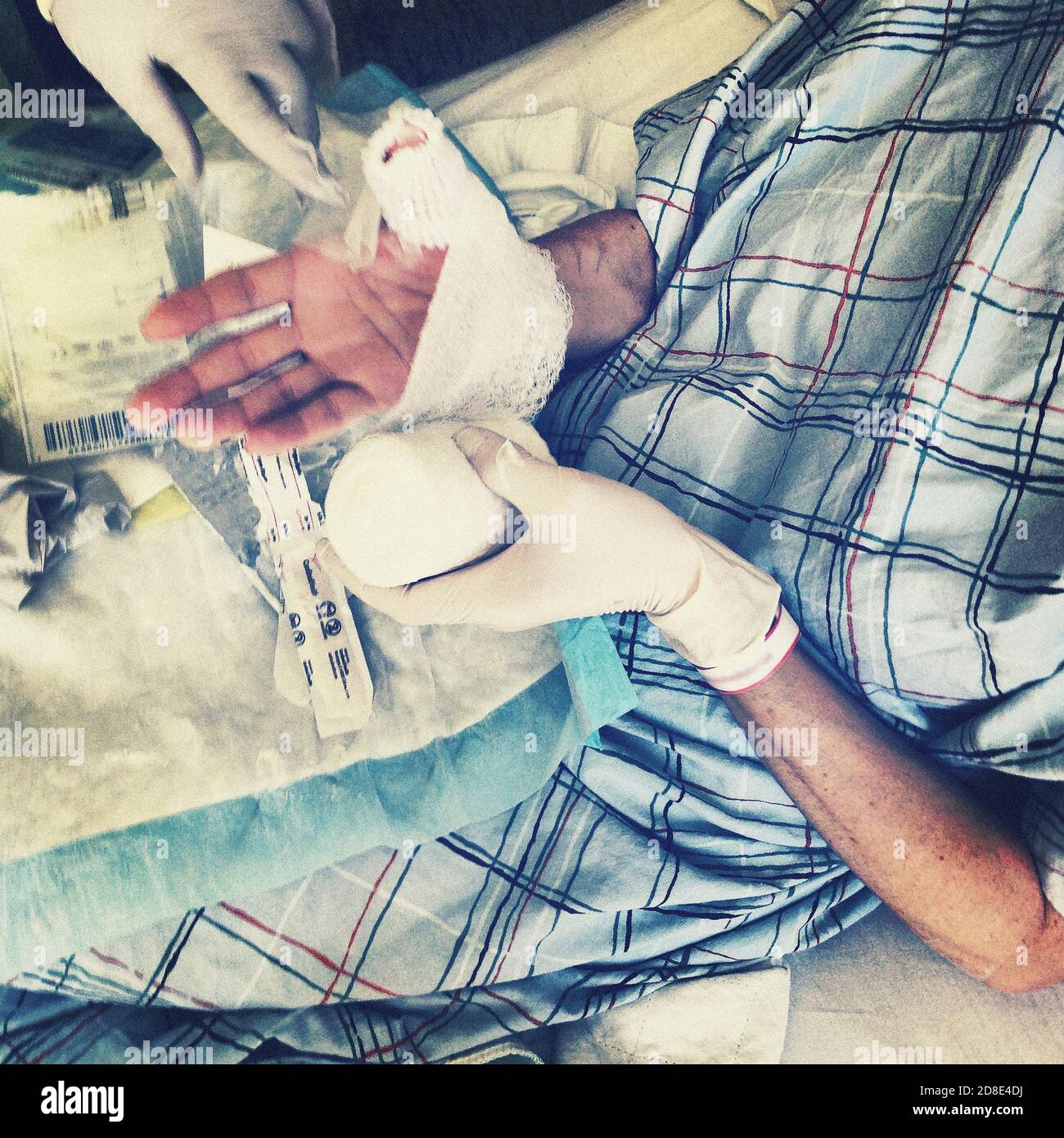 High Angle View of Woman with Injured Hand in Hospital Bed Stock Photo