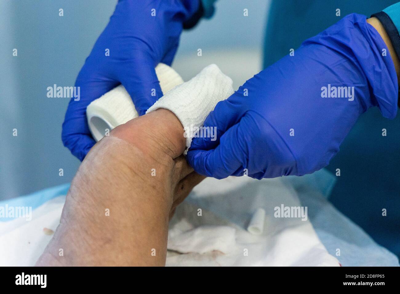 Healthcare worker nursing toe with bandage gauz after ingrown toenail