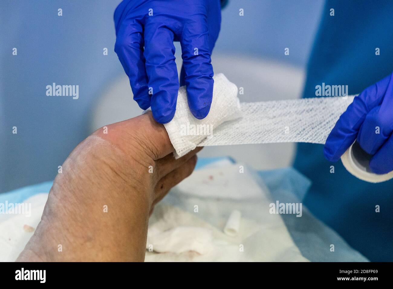 Healthcare worker nursing toe with bandage gauz after ingrown toenail