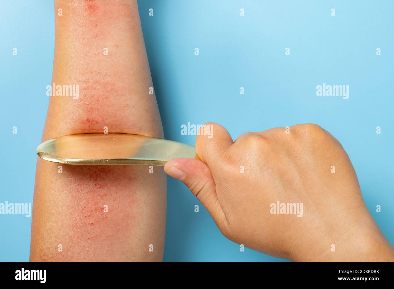 man scraping his arm by a copper scratcher which is a traditional