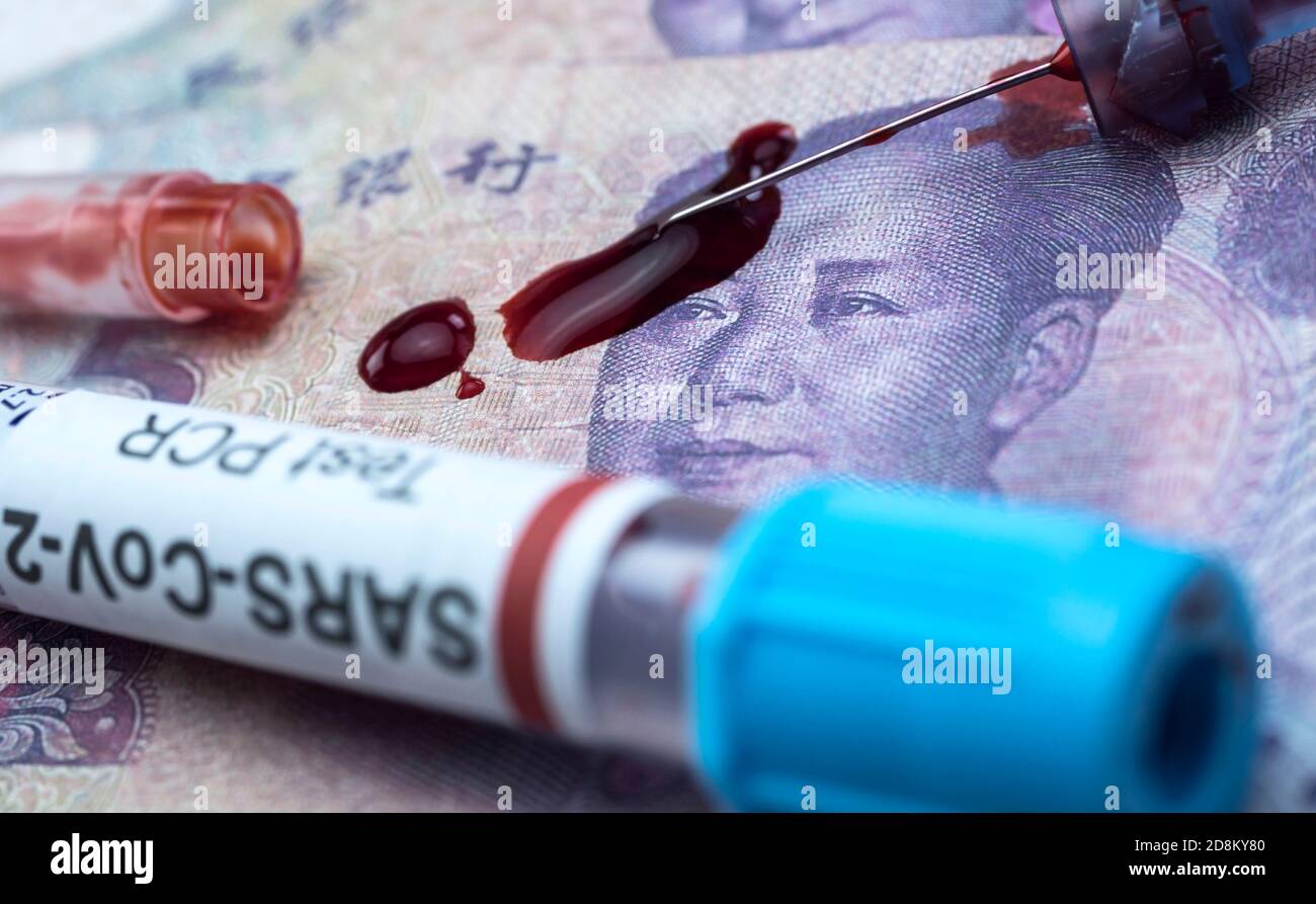 syringe with blood and covid-19 vaccine on cjinese notes Stock Photo