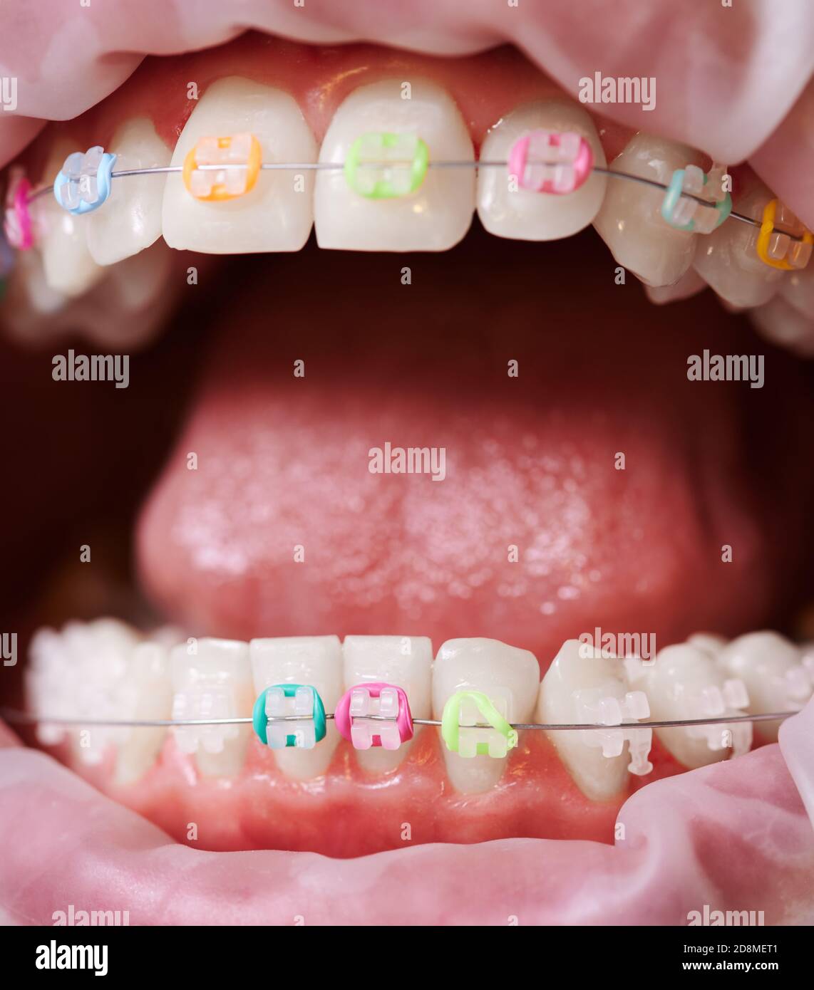 Mouth best sale rubber bands