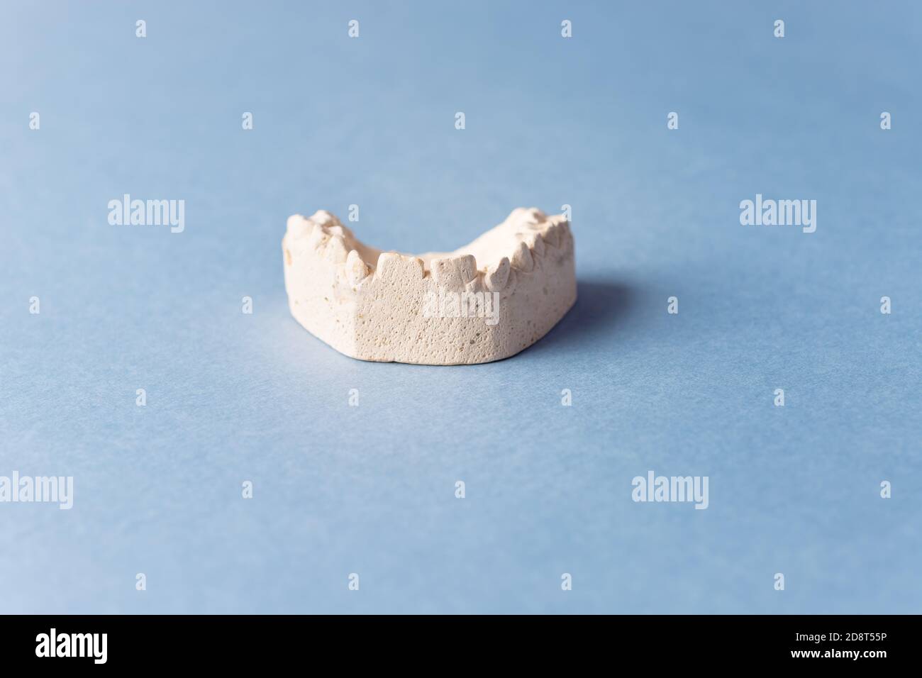 plaster cast of the children's upper jaw. Correction of bite. Stock Photo
