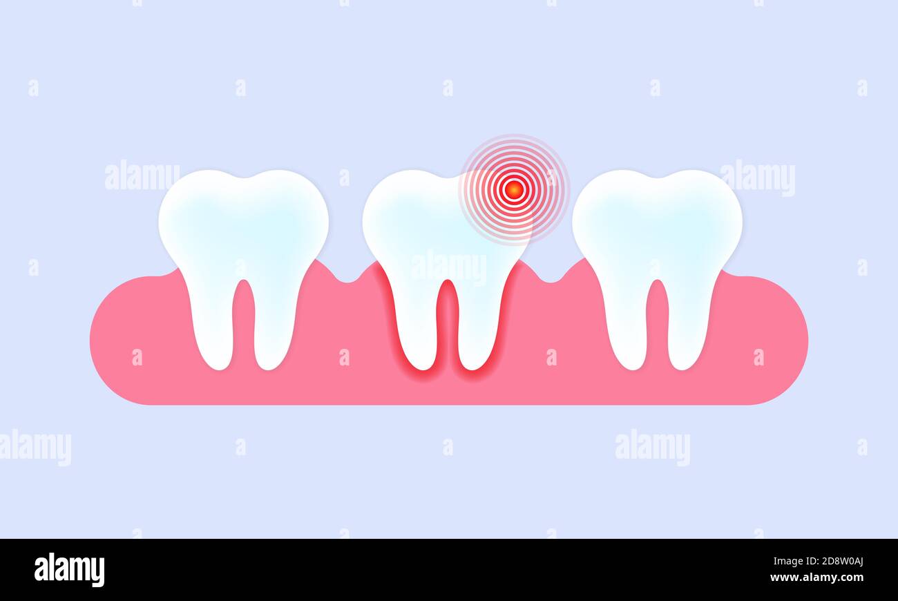 Teeth banner. Tooth with pain. Caries and toothache. Teeth care concept ...