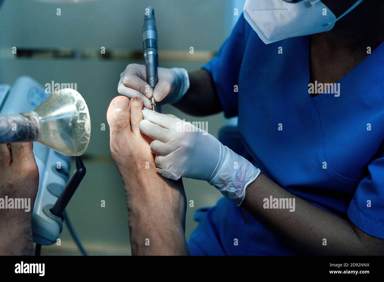 Close-up of a podiatrist wearing latex gloves and face mask treating the  feet of a grown man with corns Stock Photo - Alamy