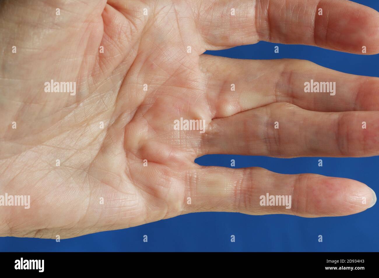 Surgical knots hires stock photography and images Alamy