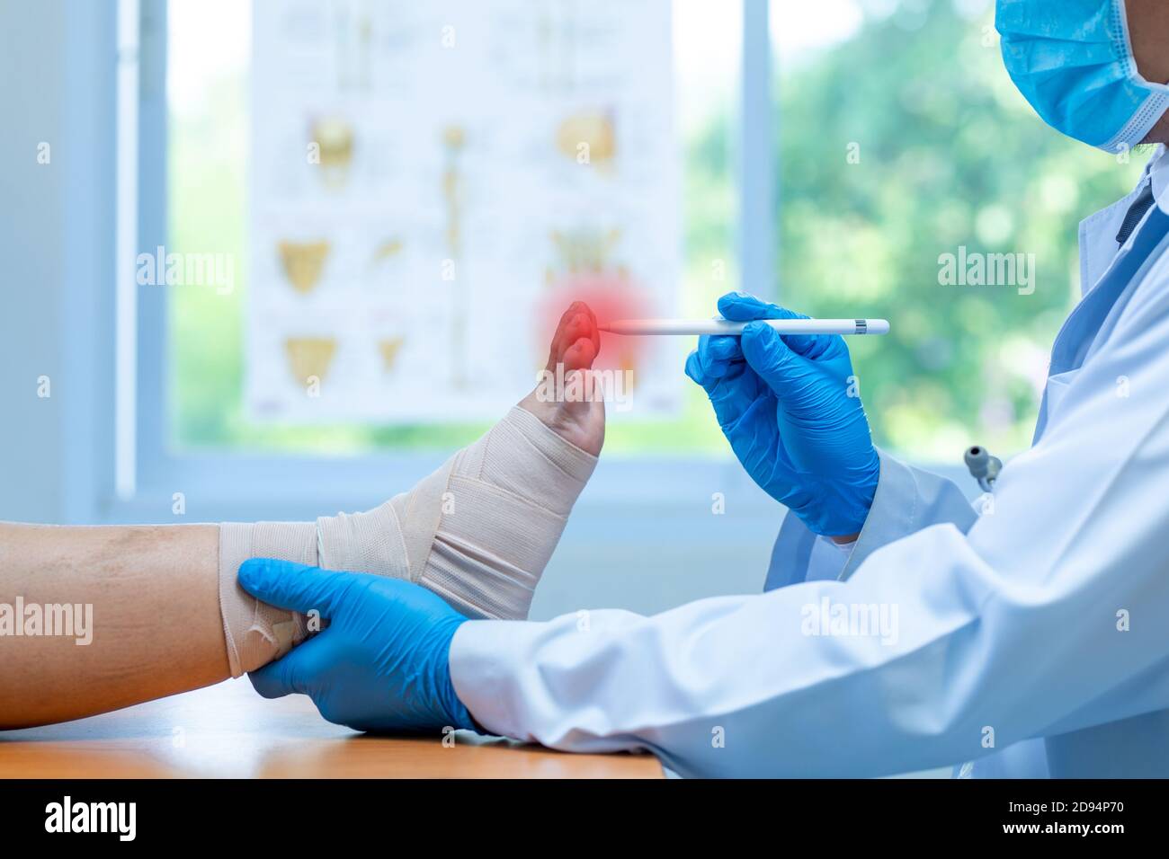 Plantar fasciitis hires stock photography and images Alamy
