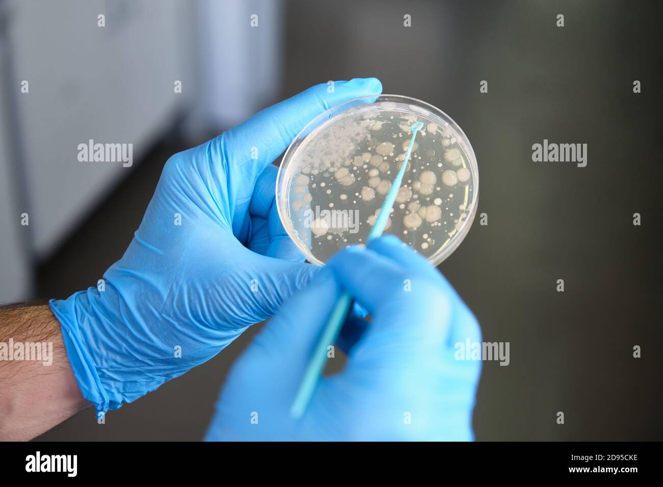 Scientist hands holding a petri dish with bacterial colonies analyzing growth