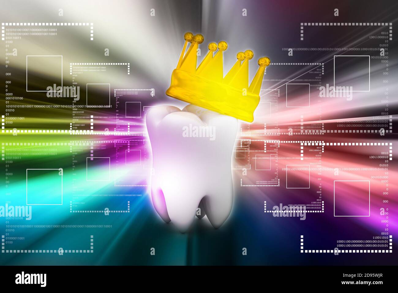 Tooth with crown Stock Photo