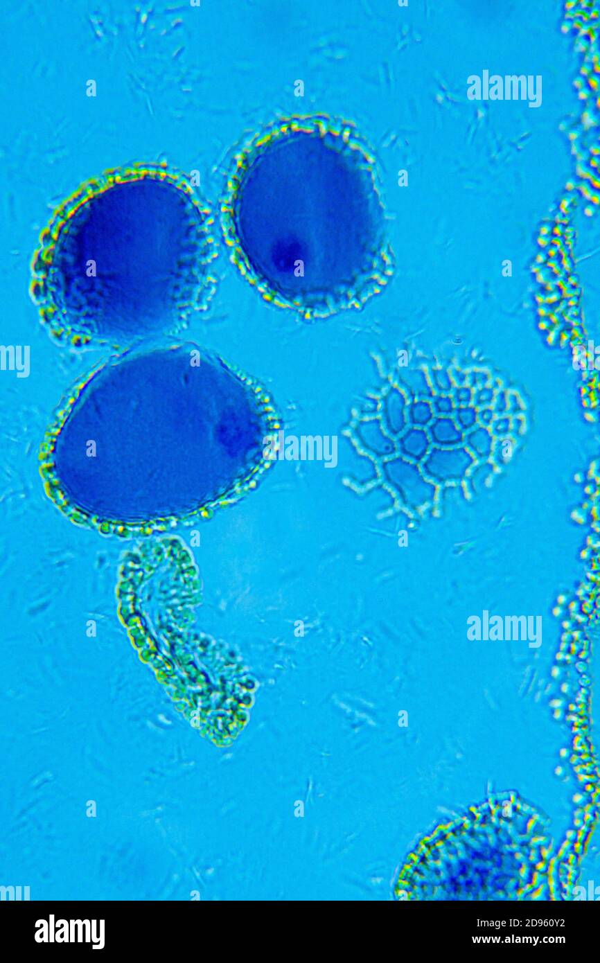 Lillium anther under Optical Microscope. Stock Photo