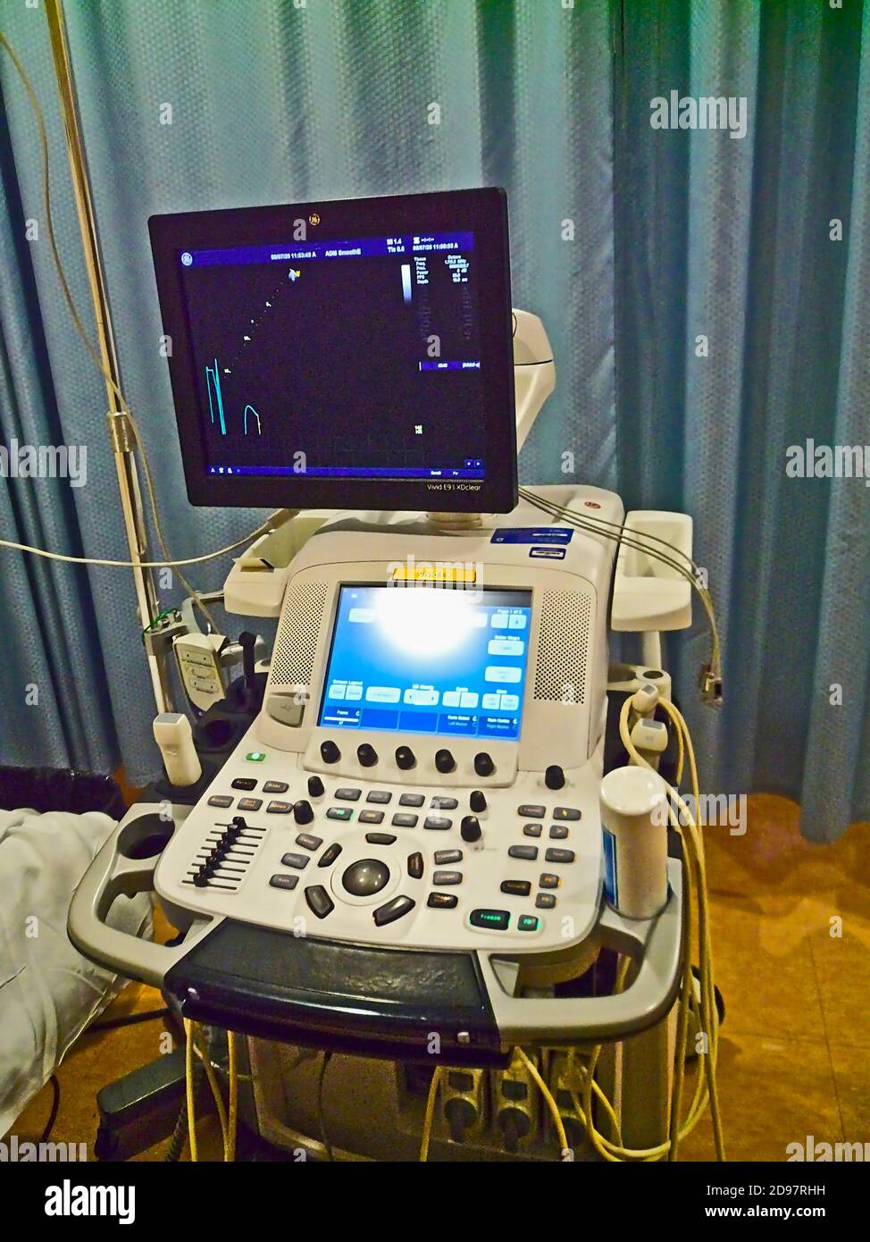 An echocardiogram test. Cardiovascular ultrasound machine. The GE Vivid