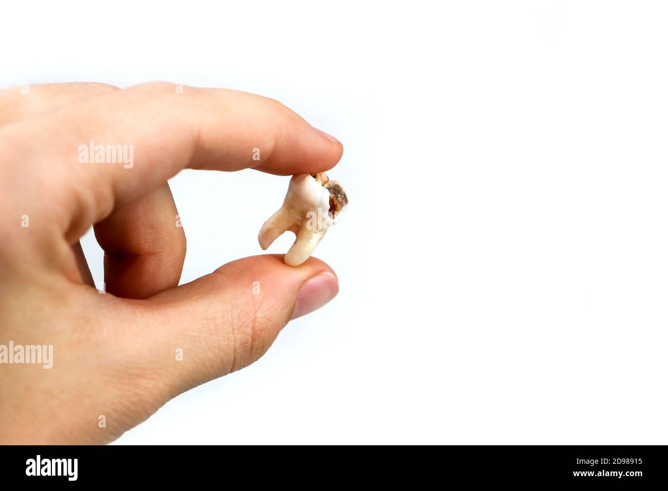 hand holding tooth A close up of a broken tooth on an isolated white background. The cause of  toothache. A bad tooth. Hand holding old removed wisdom tooth from kid  mouth isolated on white background,
