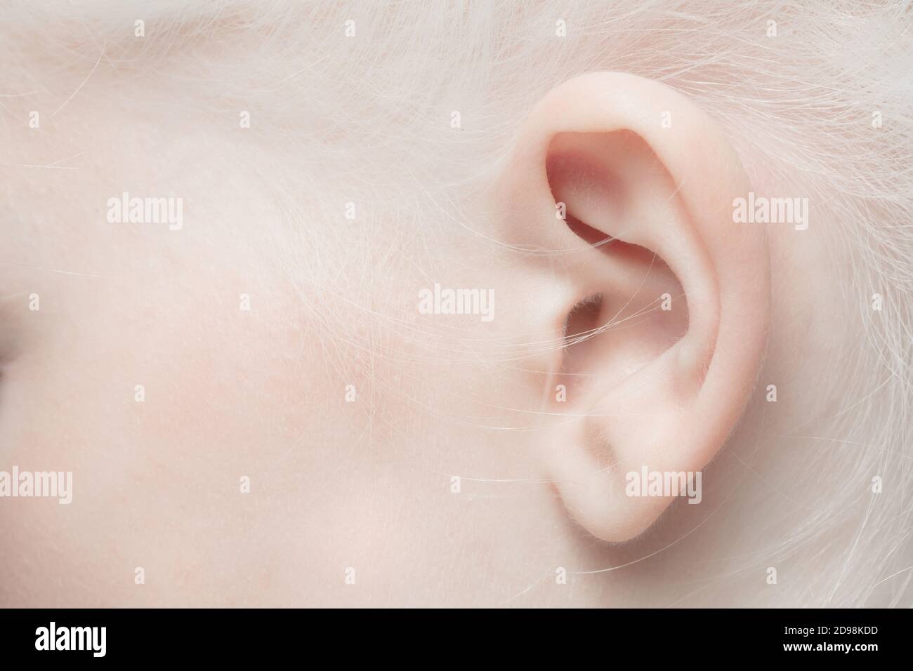 Ear Close Up Portrait Of Beautiful Albino Female Model Parts Of Face And Body Beauty Fashion Skincare Cosmetics Wellness Concept Copyspace Well Kept Skin Fresh Look Details Stock Photo Alamy