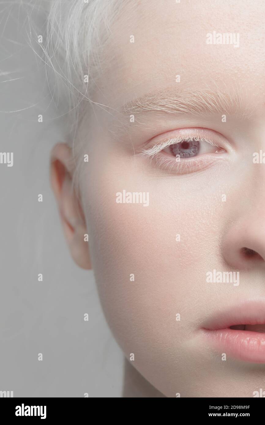 Eyes open. Close up portrait of beautiful albino female model. Parts of  face and body. Beauty, fashion, skincare, cosmetics, wellness concept.  Copyspace. Well-kept skin, fresh look, details Stock Photo - Alamy