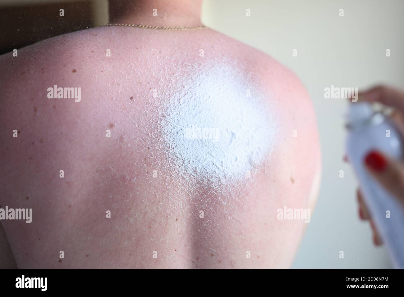 Sun burnt tan sunbathing hires stock photography and images Alamy